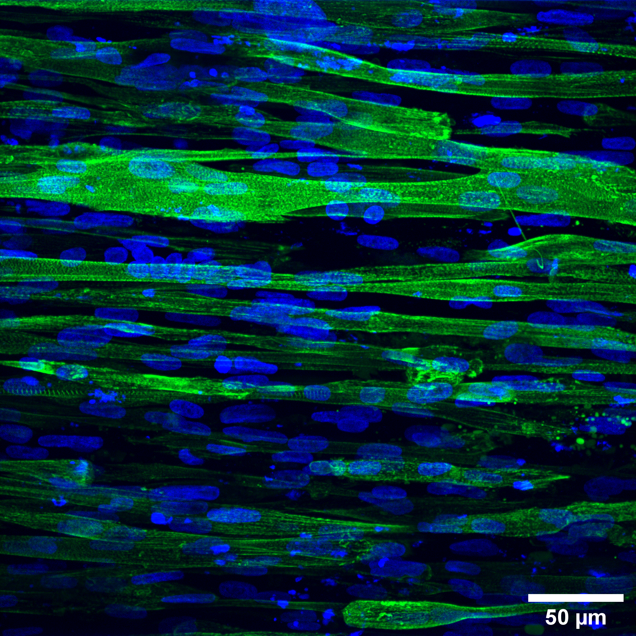 Picture of diseased cells